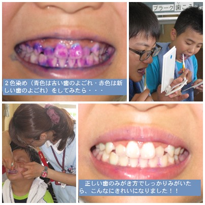 140626 歯科指導１.jpg
